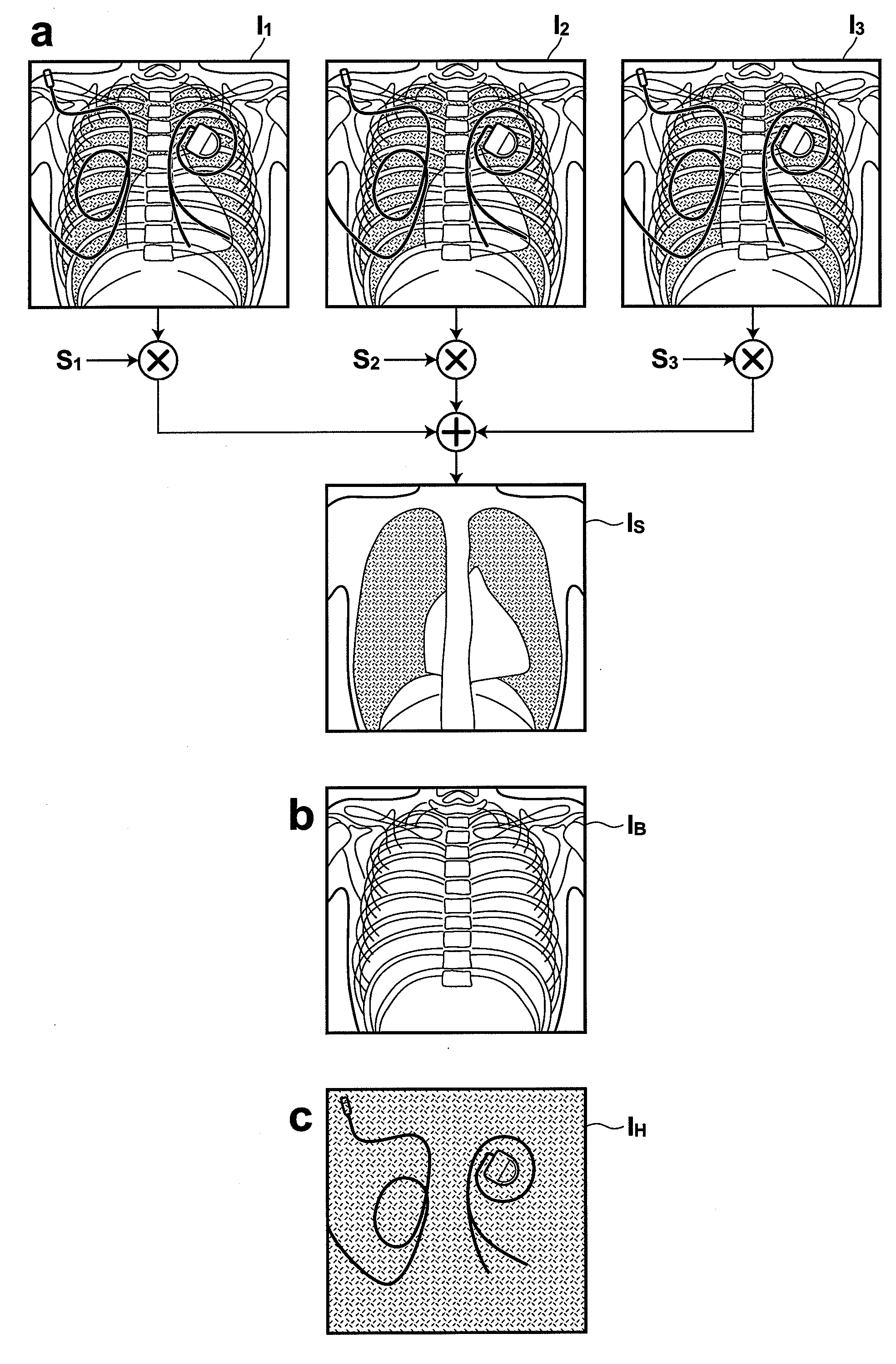 Device, method and recording medium containing program for separating image component