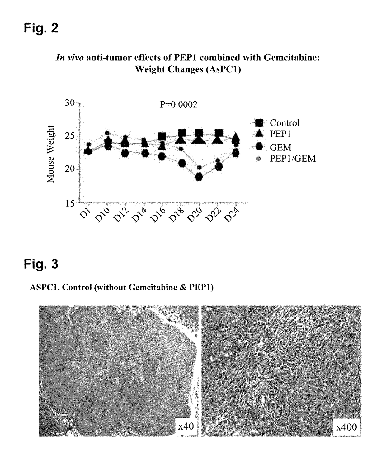 Peptide having fibrosis inhibitory activity and composition containing same