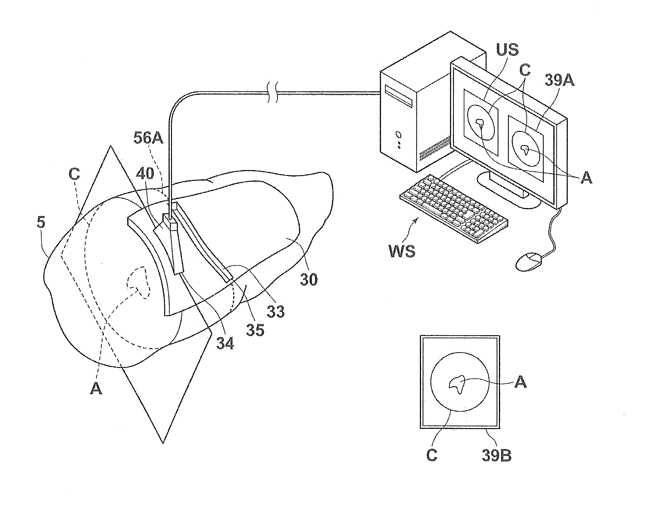 Pattern and surgery support set, apparatus, method and program