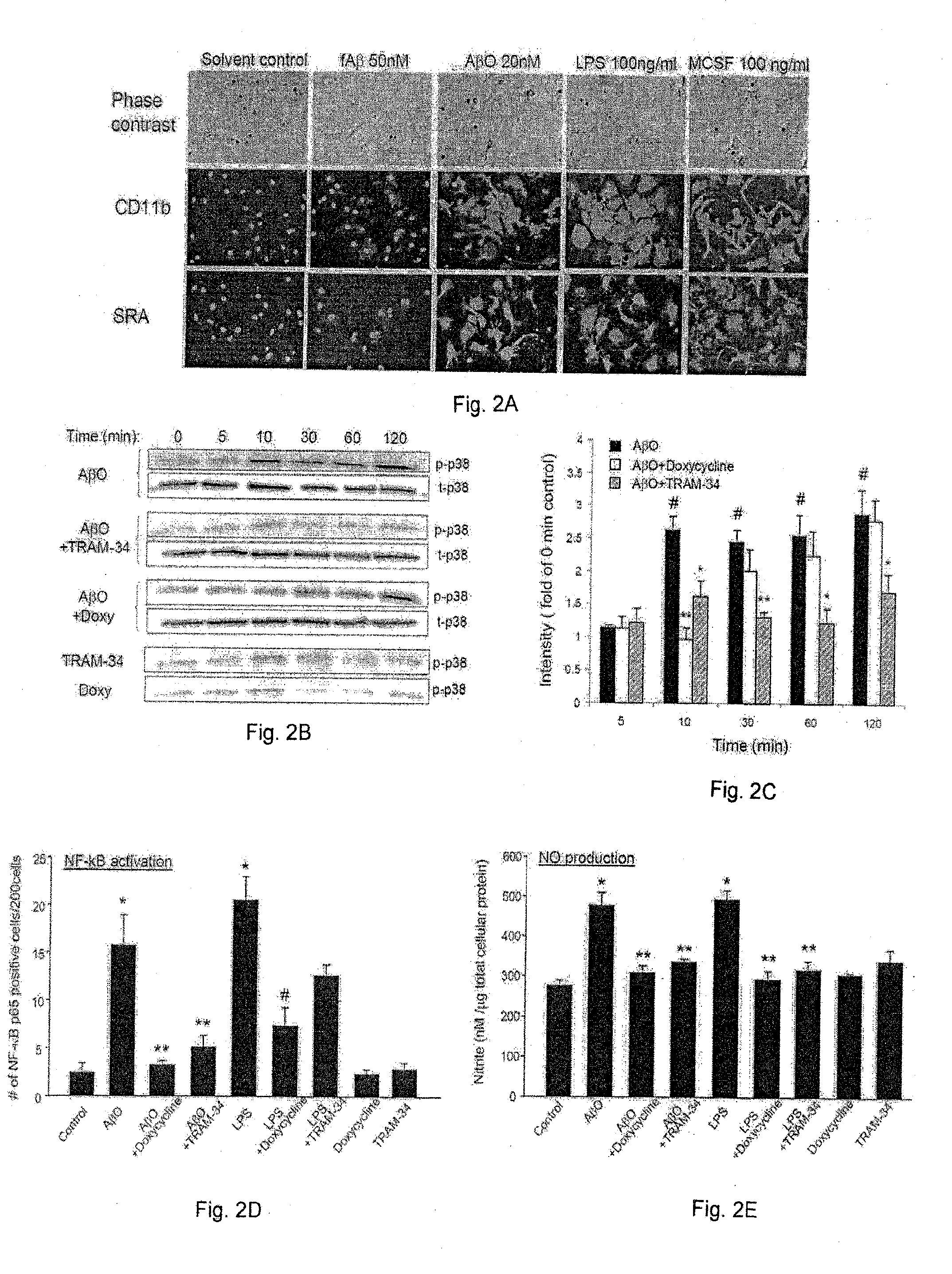 Reduction of Microglia-Mediated Neurotoxicity by KCa3.1 Inhibition