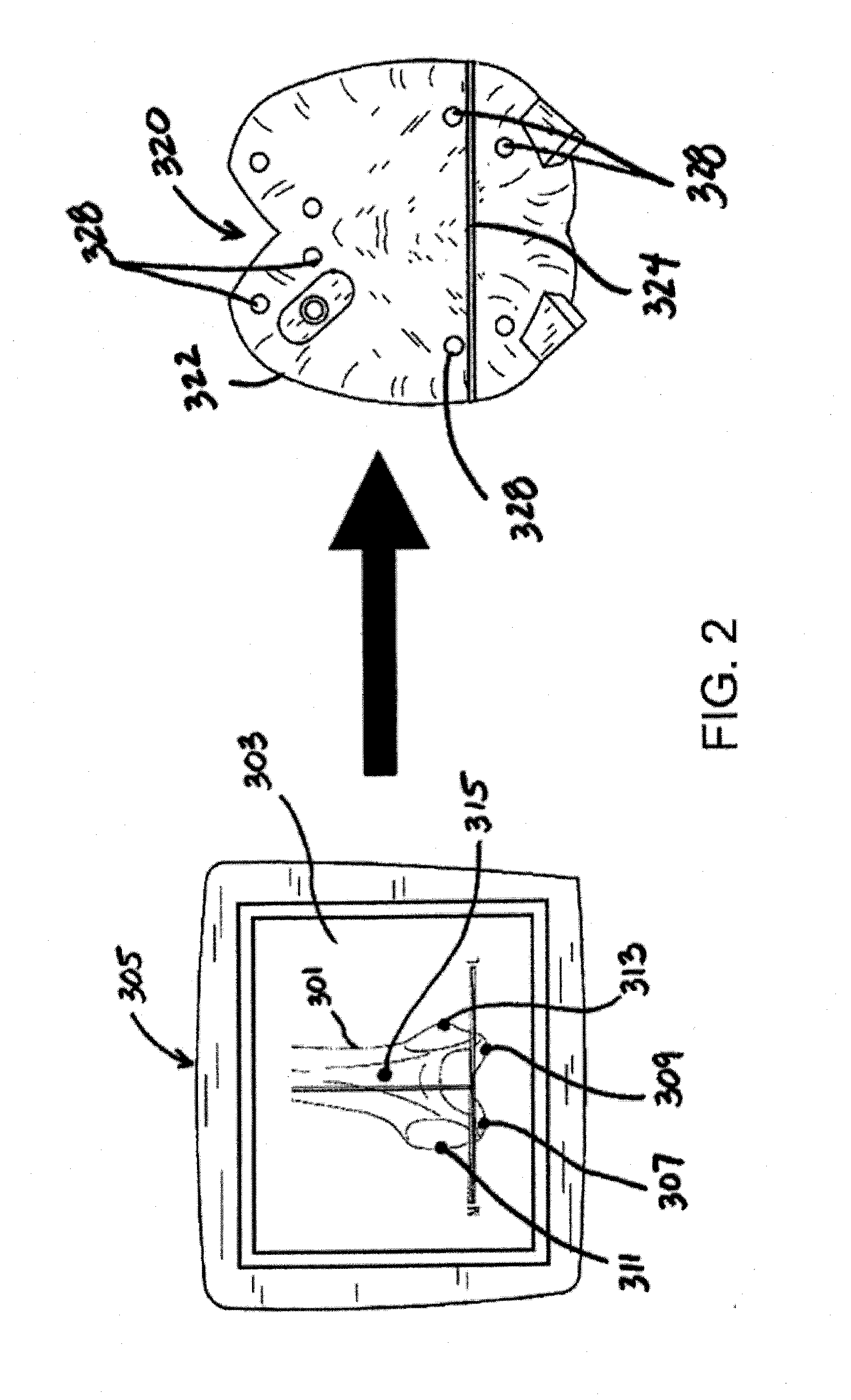 Patient-matched surgical component and methods of use