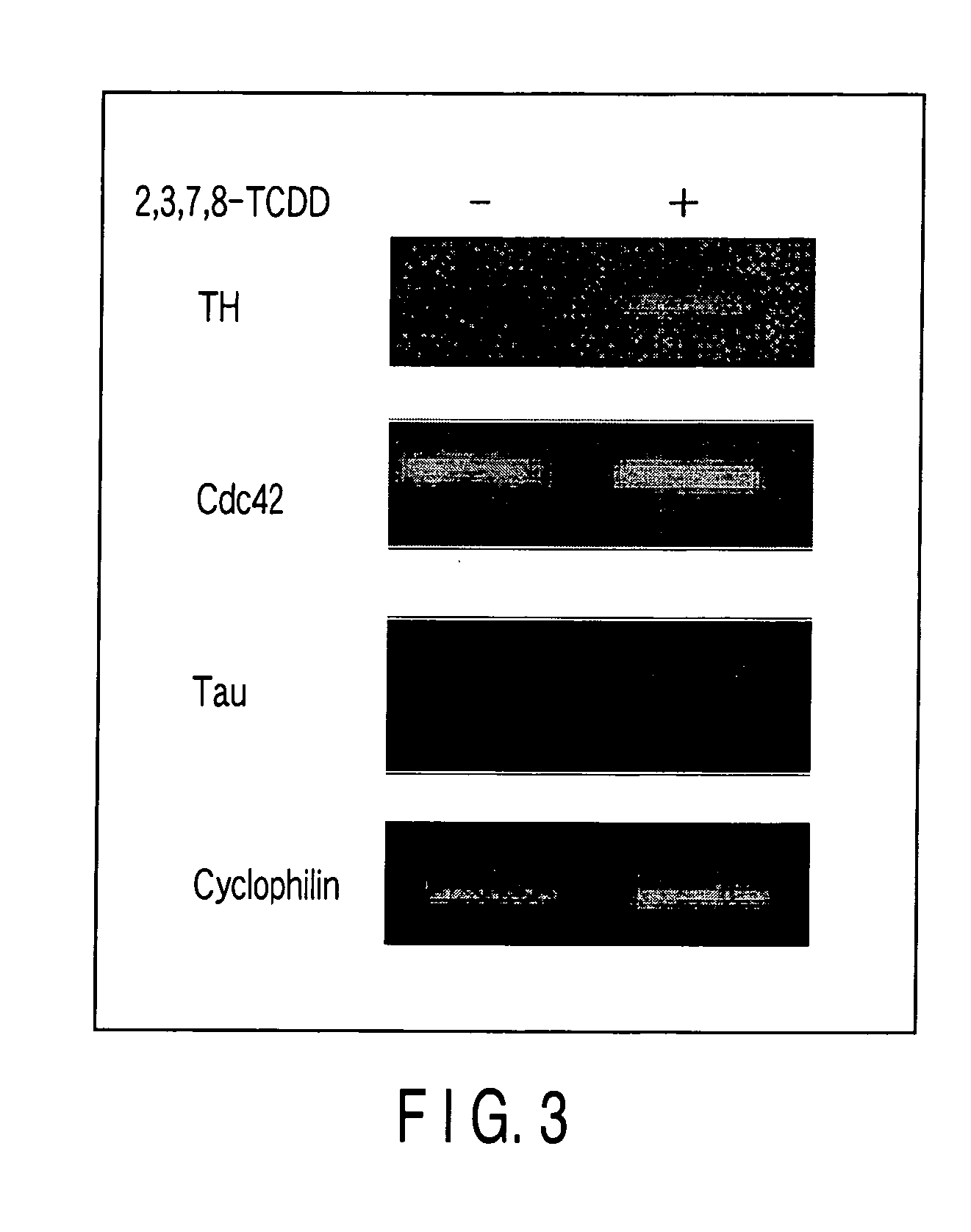 Cells and methods for estimation of effects on neurological dysfunction