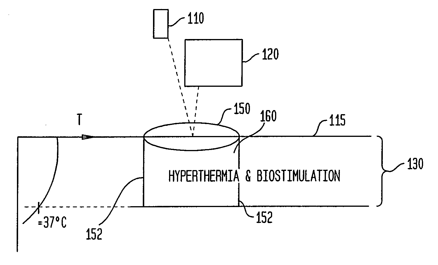 Methods and apparatus for performing photobiostimulation