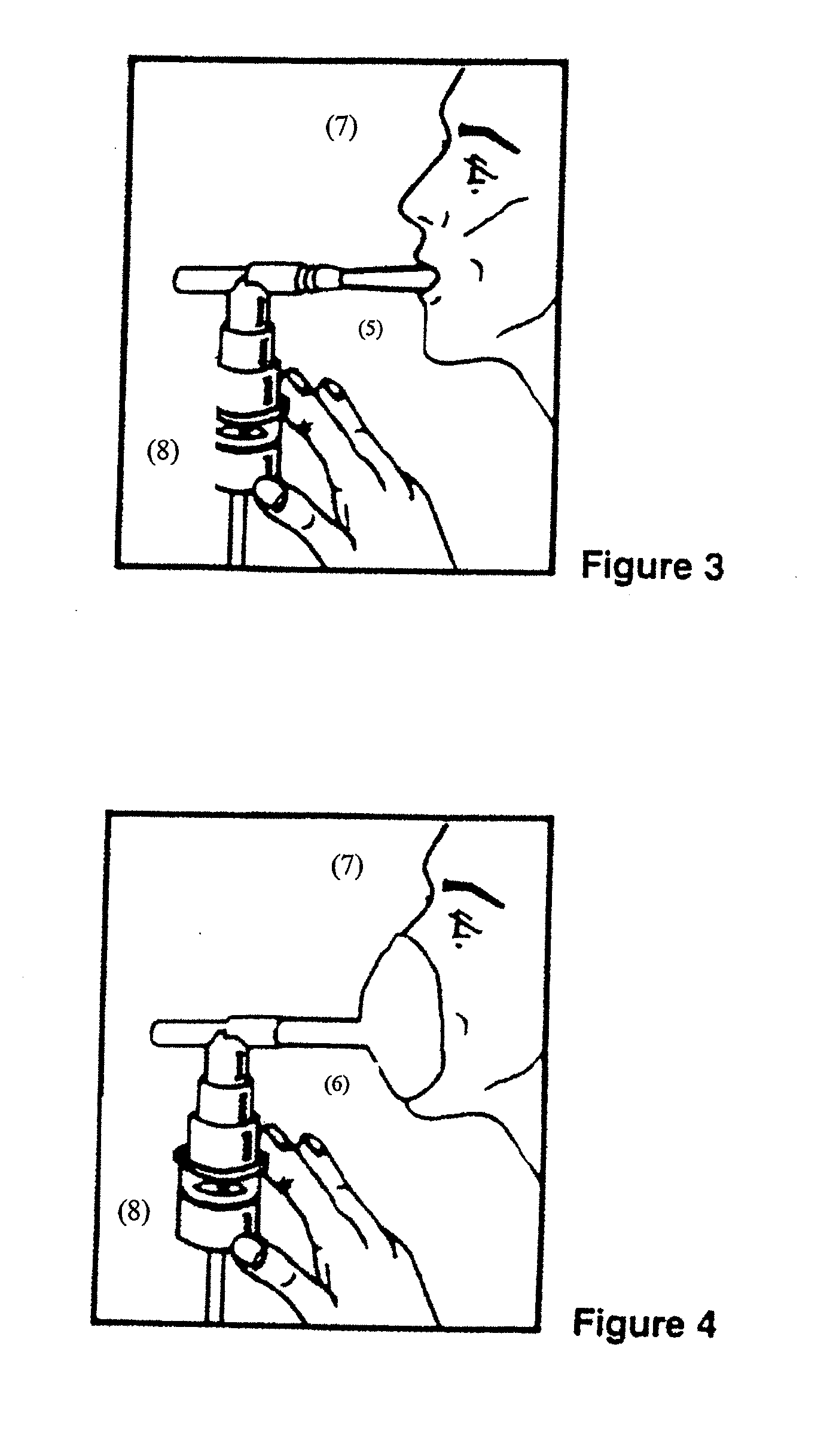 Albuterol and ipratropium inhalation solution, system, kit and method for relieving symptoms of chronic obstructive pulmonary disease