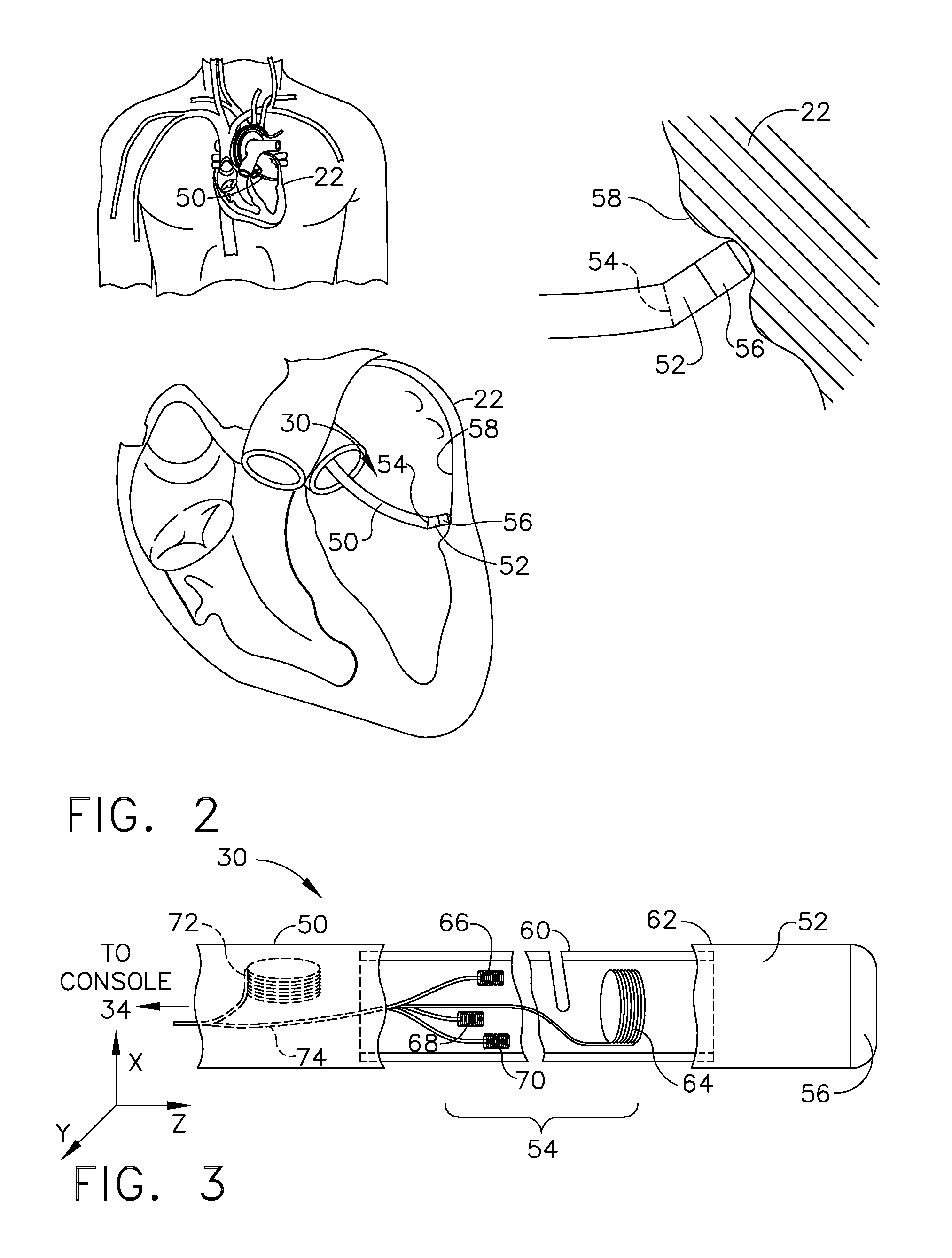 System and method for detection of metal disturbance based on mutual inductance measurement