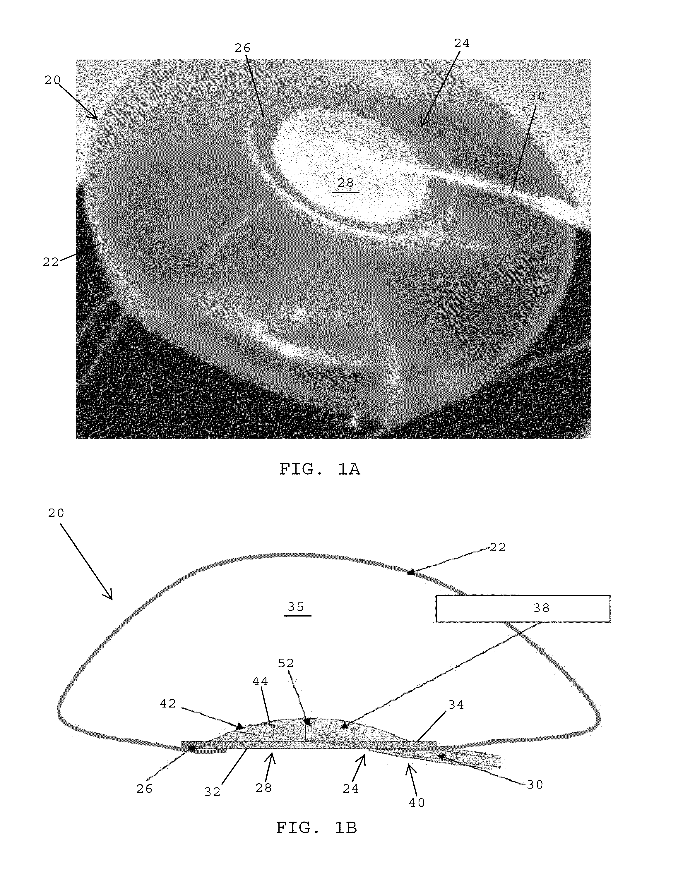Valve assemblies for expandable implants and tissue expanders