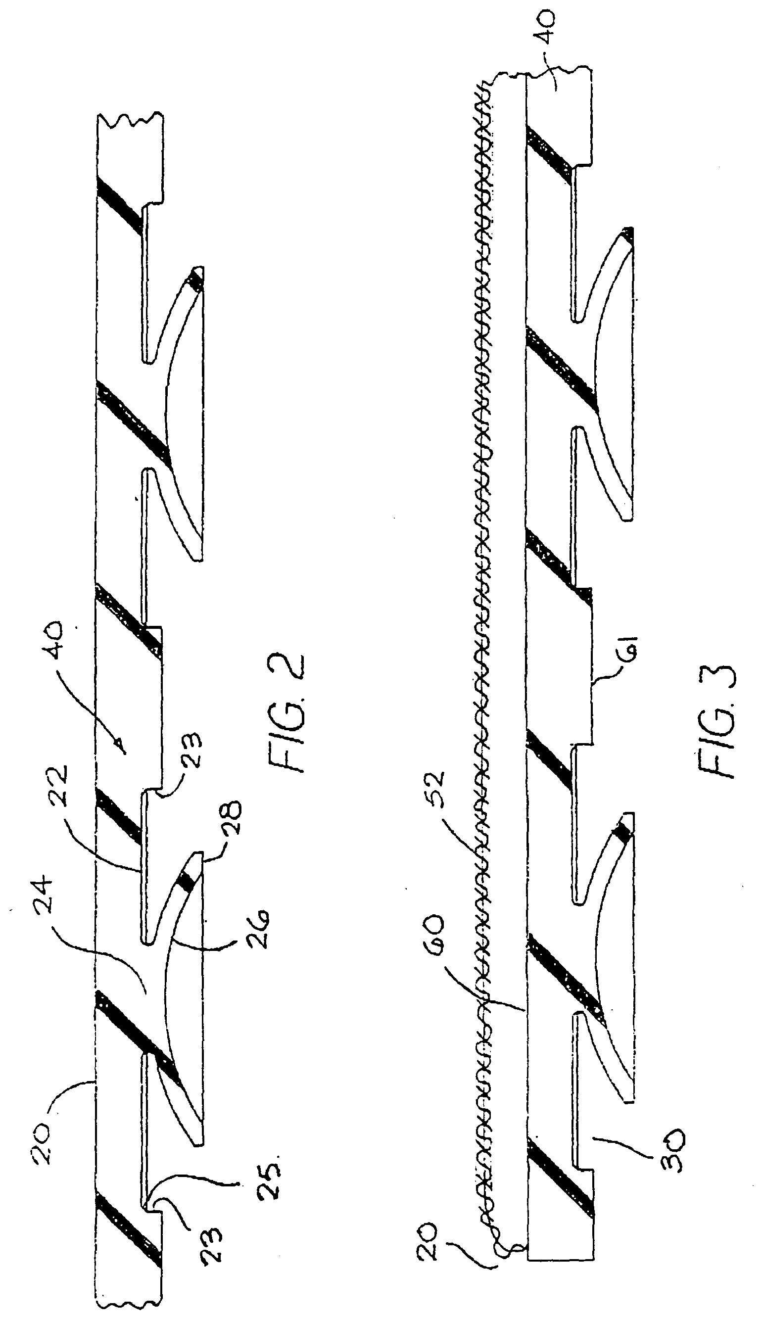 Slip resistant mat