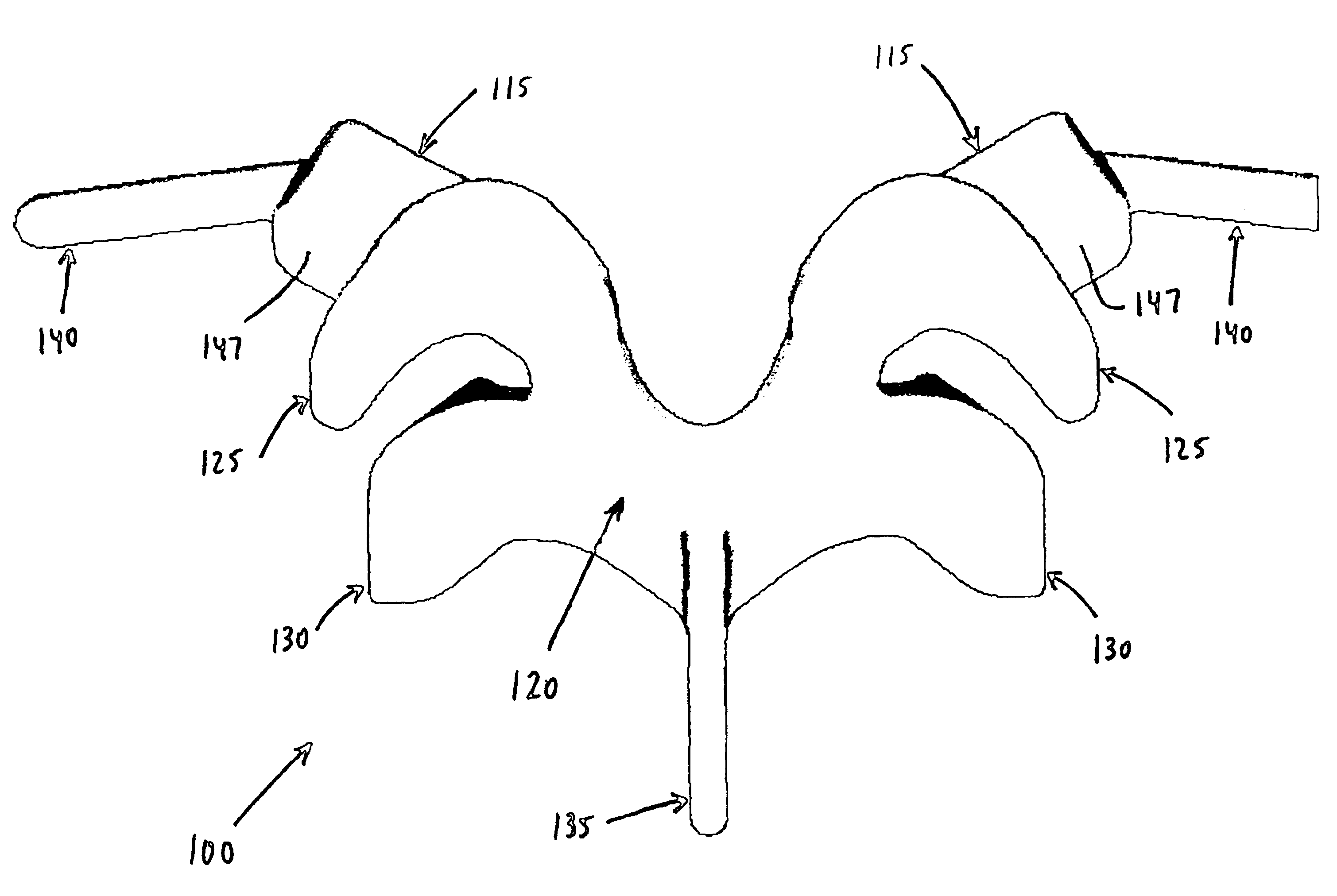 Prosthesis for the replacement of a posterior element of a vertebra