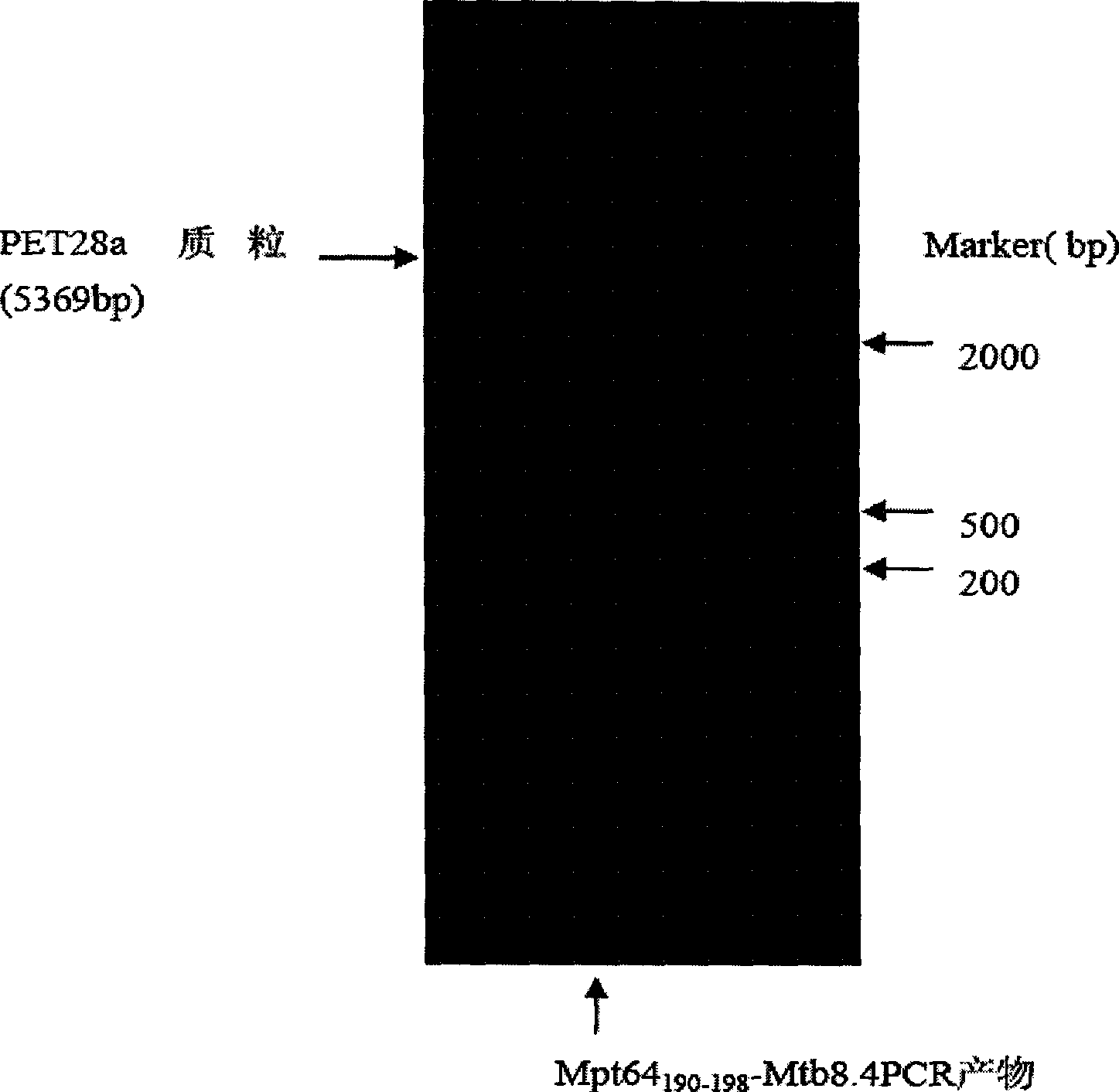 Tubercle bacillus recombined protein and expressing purefying method and application thereof