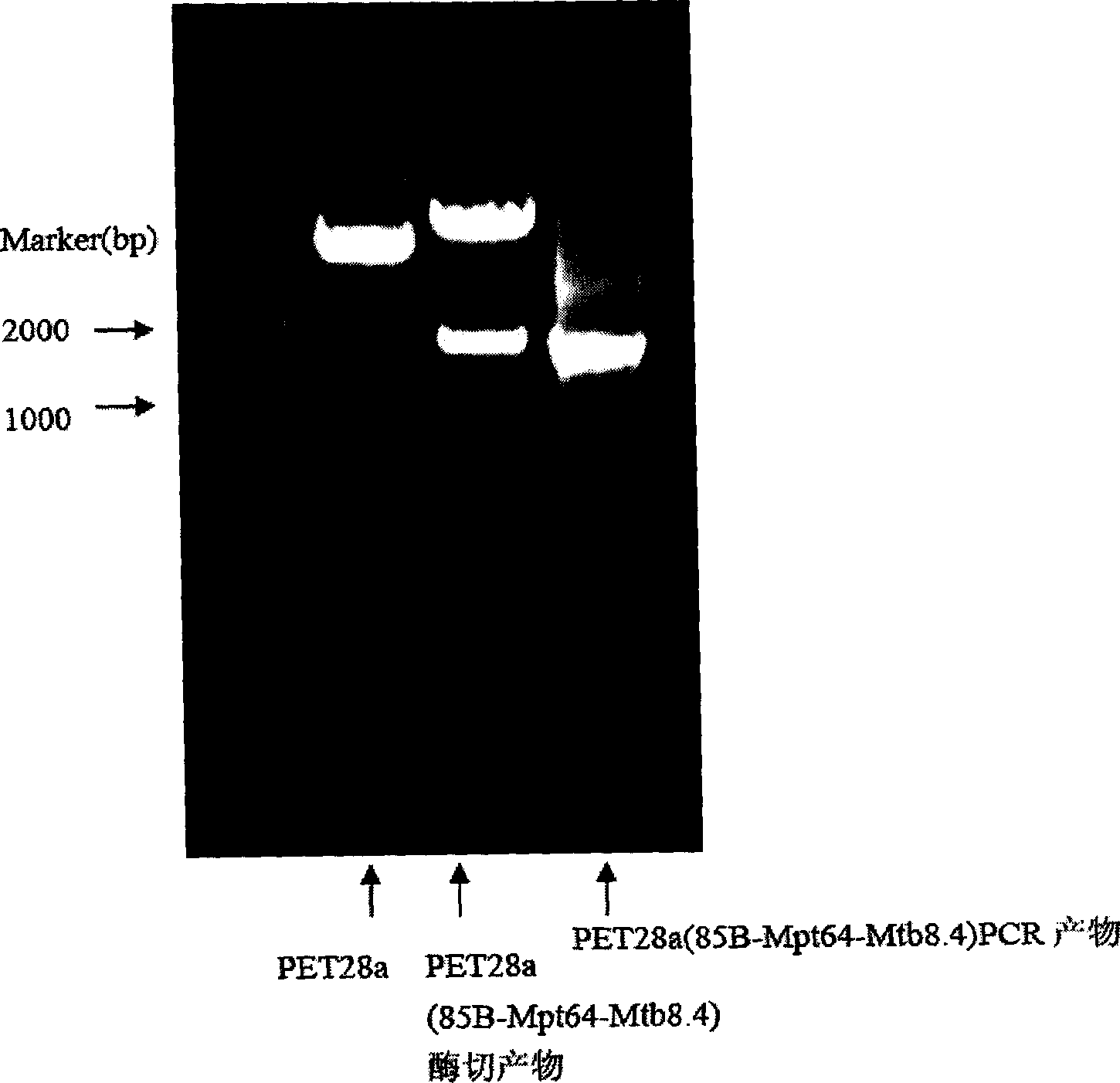 Tubercle bacillus recombined protein and expressing purefying method and application thereof