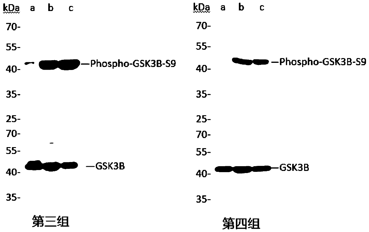 Method for preparing ATP in vitro phosphorylation sample