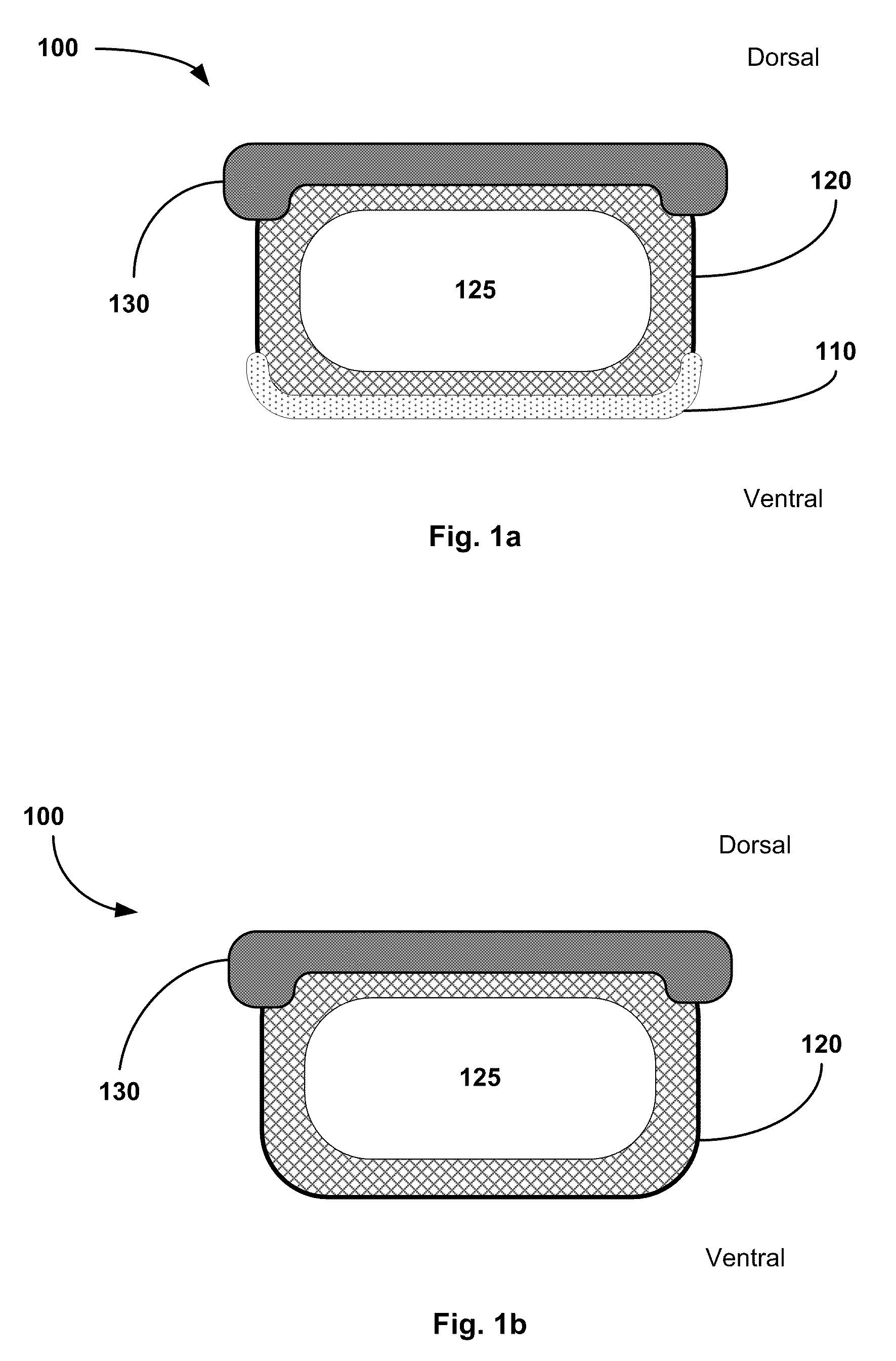 Multi-layer osteoinductive, osteogenic, and osteoconductive carrier