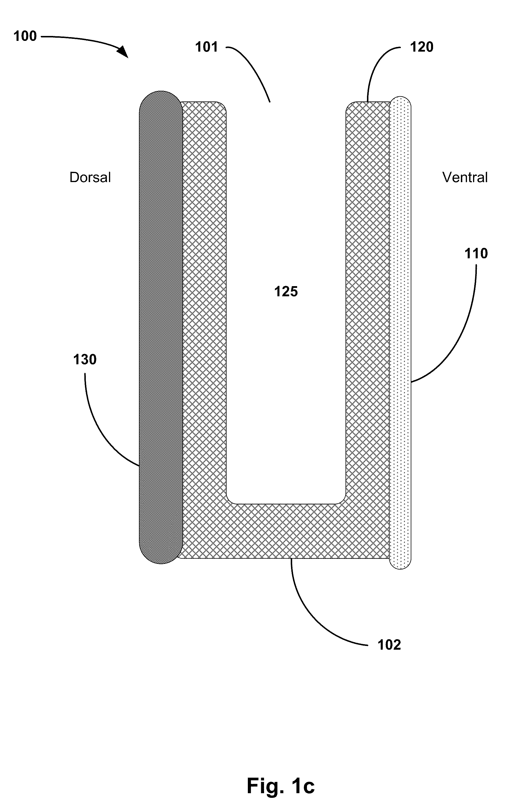 Multi-layer osteoinductive, osteogenic, and osteoconductive carrier