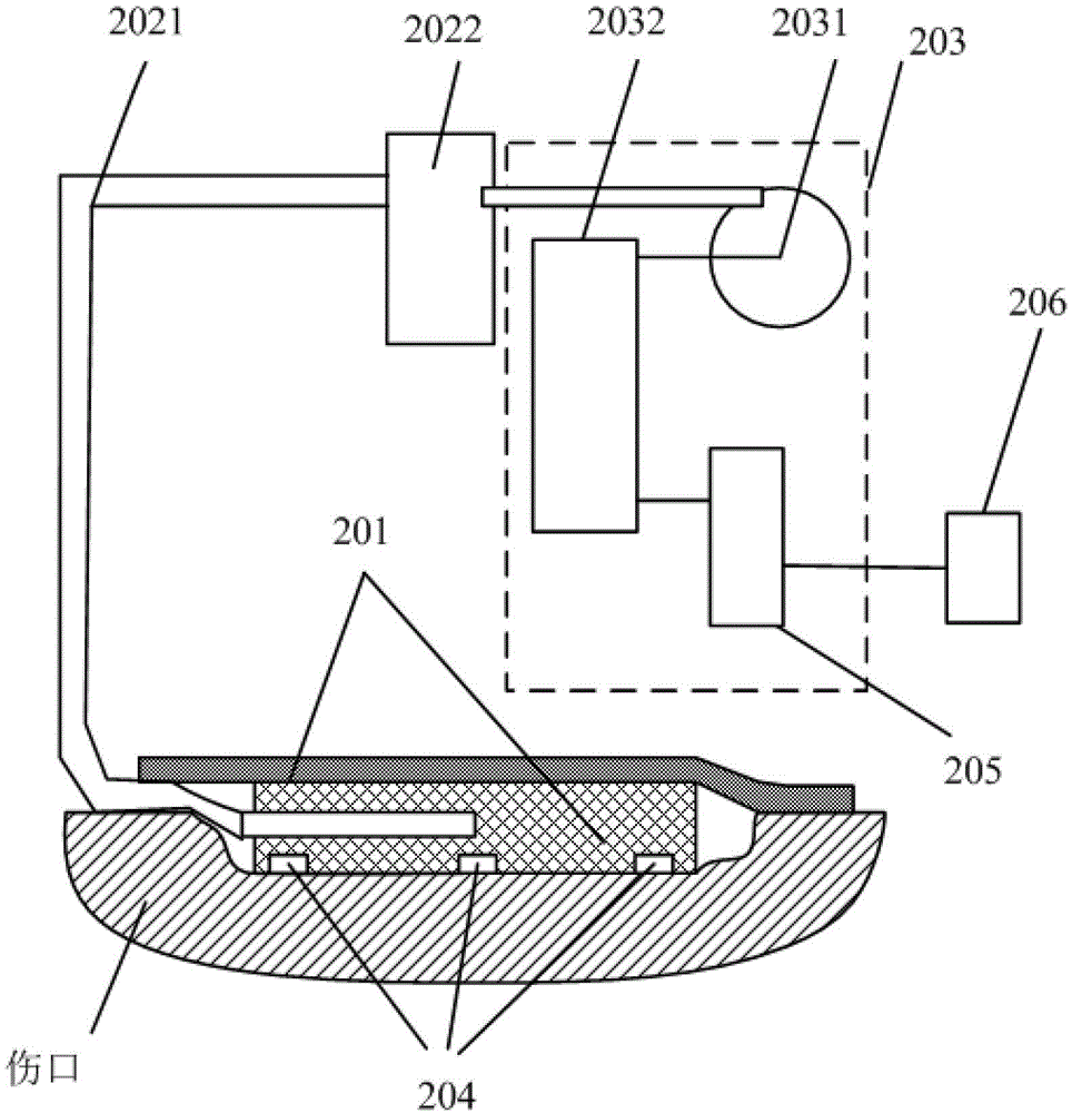 Negative-pressure wound treating system based on monitoring and managing of wound treating state