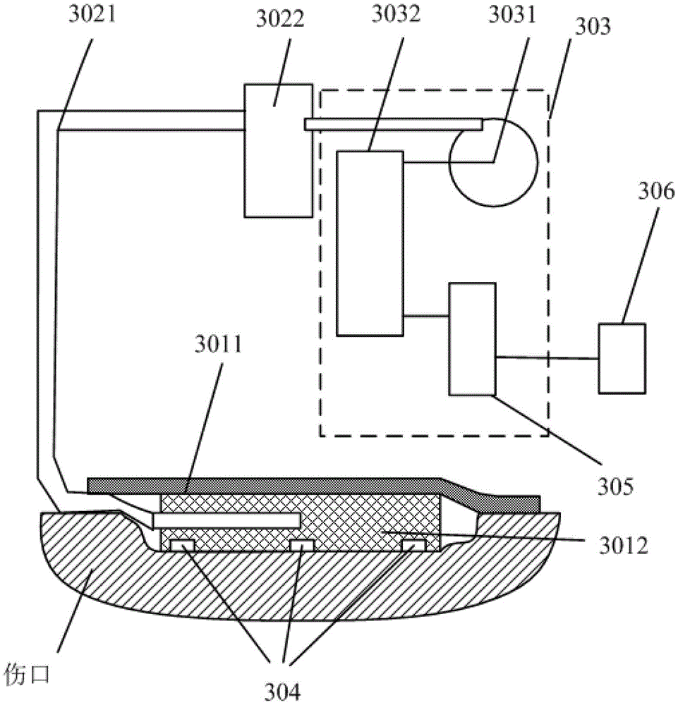 Negative-pressure wound treating system based on monitoring and managing of wound treating state