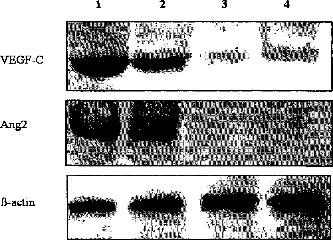 Application of Ang-2 and genes thereof in pharmacy