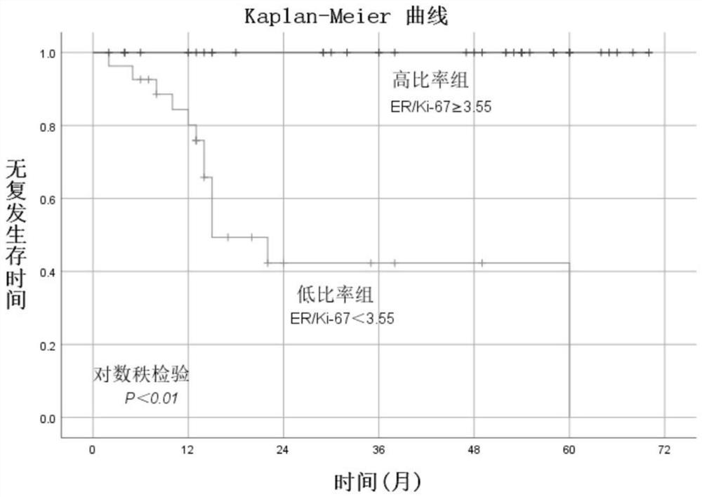 Application of ER and Ki-67 expression ratio in EC and AH retention fertility function treatment prognosis