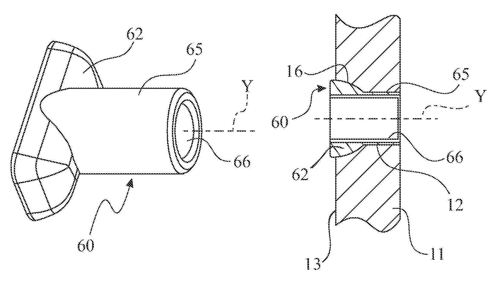 Connection of a flanged ring of a hub bearing unit to a motor vehicle wheel or suspension standard of a motor vehicle