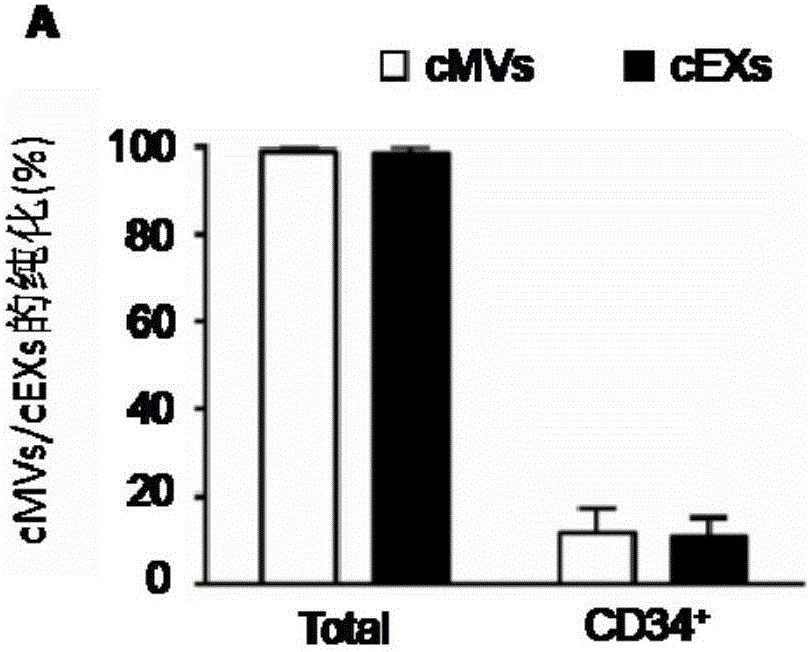 Separation and extraction method for cytomembrane microvesicles (MVs) and exosomes (EXs)