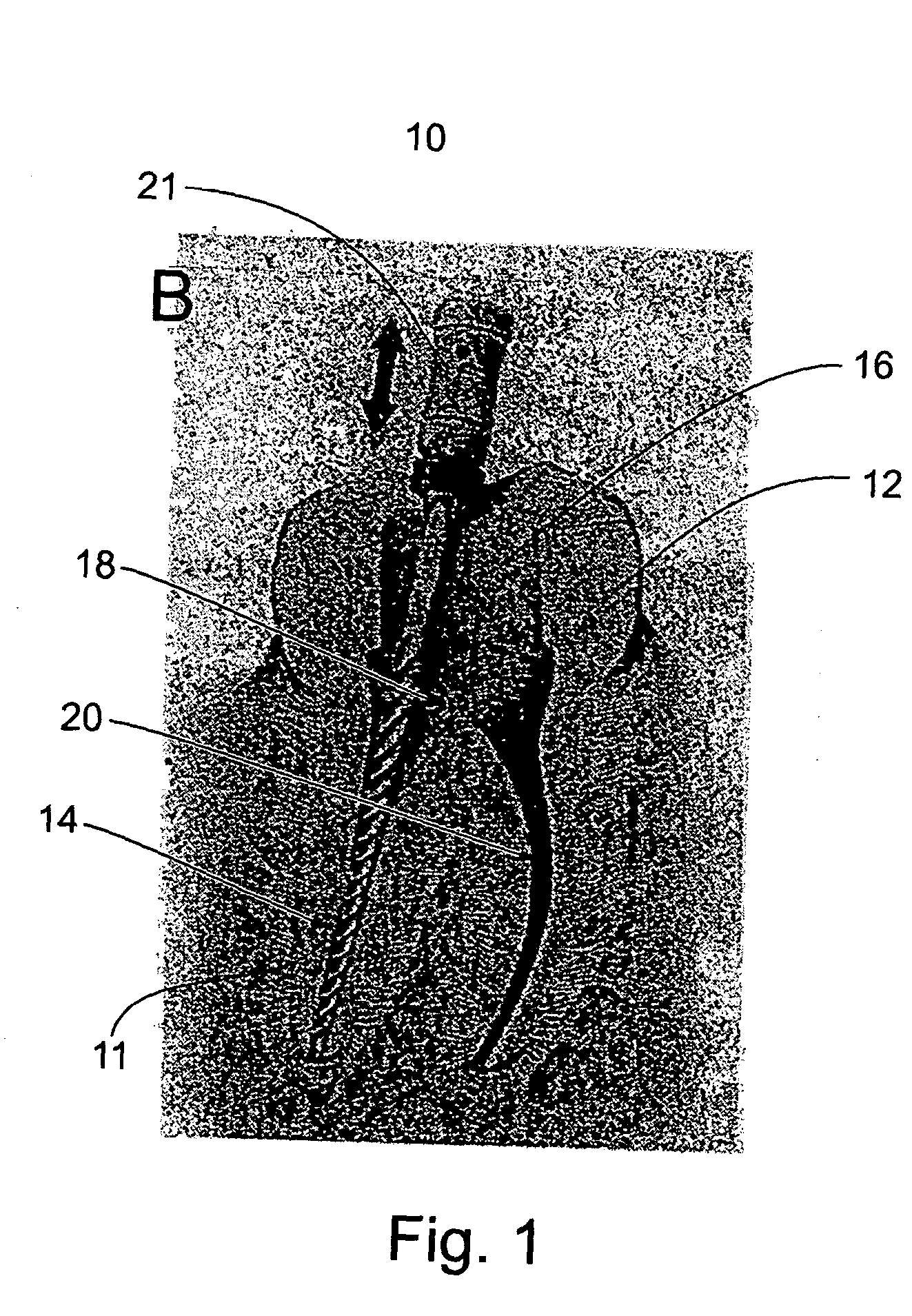 Device, method and materials for mobilizing substances into dentinal tubules in root canal treatment