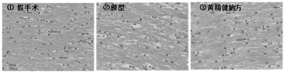 Traditional Chinese medicine composition for treating leukoencephalopathy and application thereof