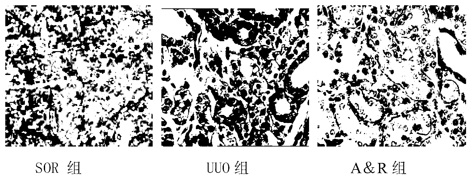 Medicine composite for treating chronic kidney diseases and preparation method and application of medicine composite