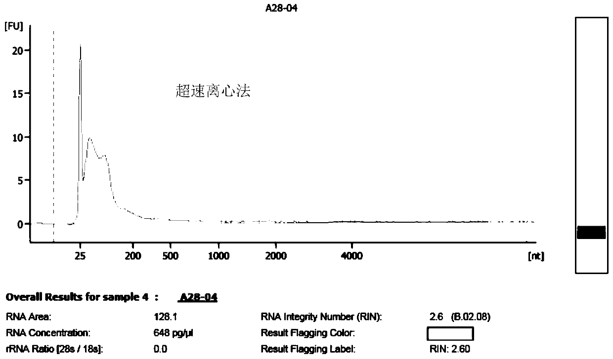 Biomarker for prostatic cancer diagnosis grading and benign and malignant condition prediction and detection kit