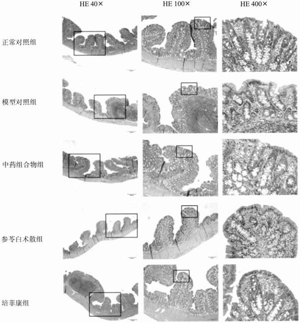 Medicinal and edible traditional Chinese medicine composition for treating functional diarrhea