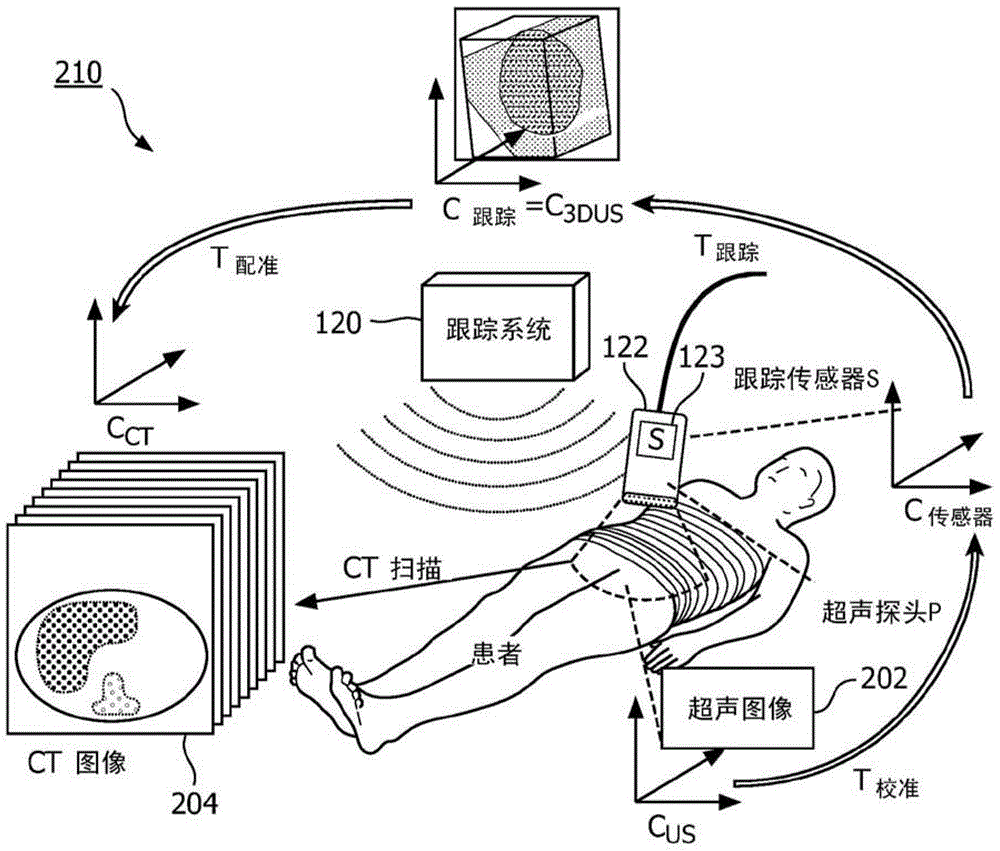 Systems and methods for automatic initialization and registration of navigation systems