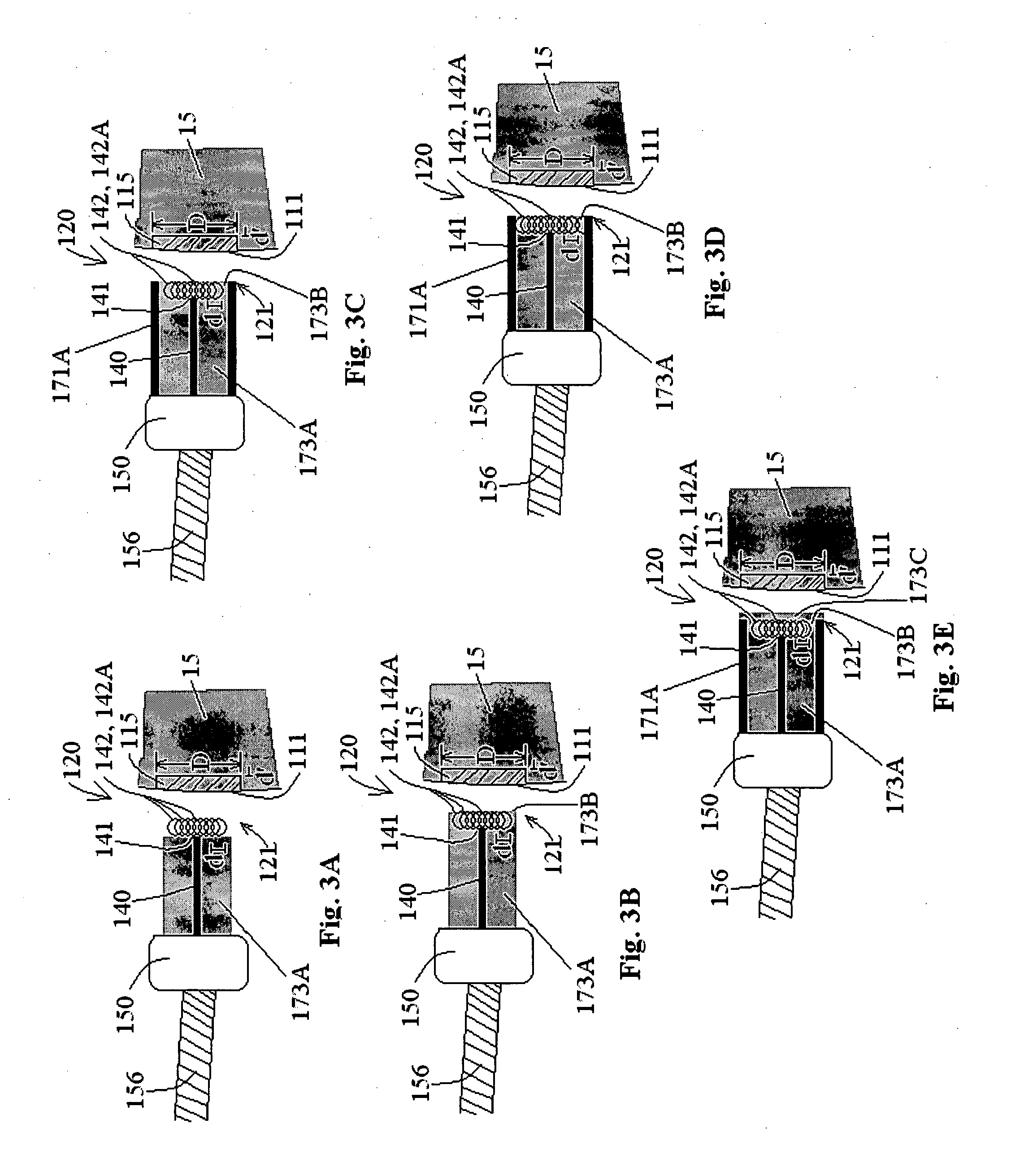 Probes, systems, and methods for examining tissue according to the dielectric properties thereof
