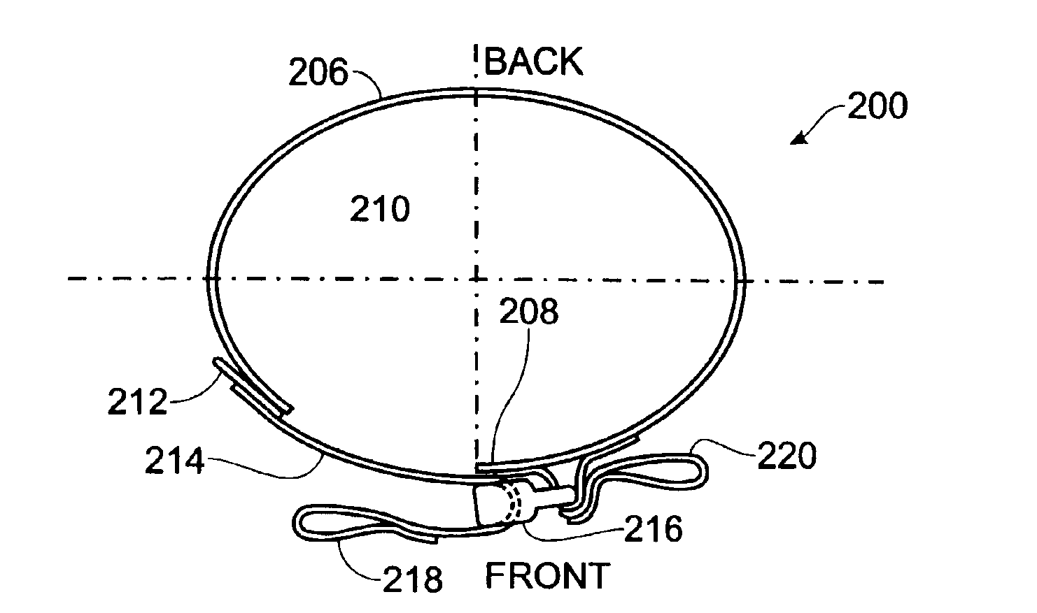 Apparatus and method for stabilizing pelvic ring disruption