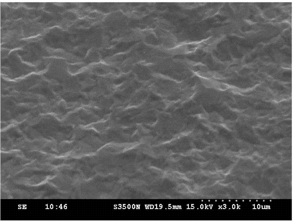 Surface treatment method for forming micro-porous structure on surface of aluminum alloy
