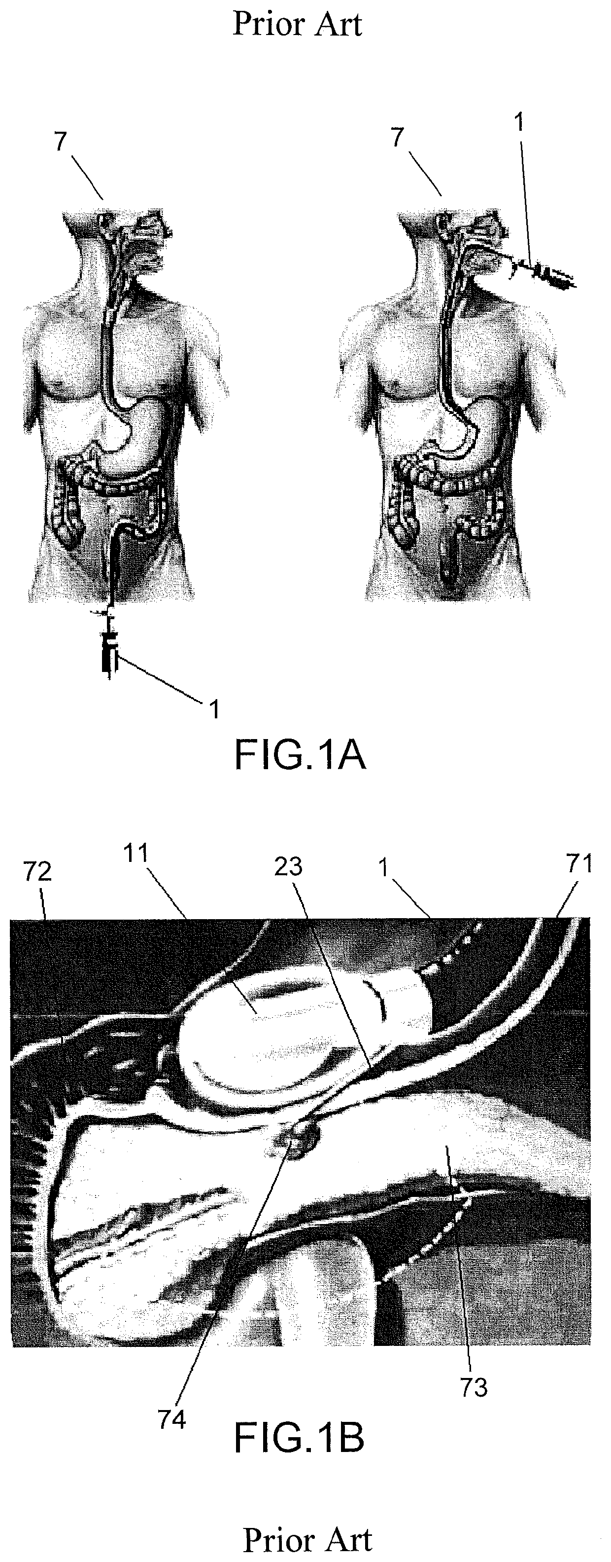 Method, an optical probe and a confocal microscopy system for inspecting a solid organ