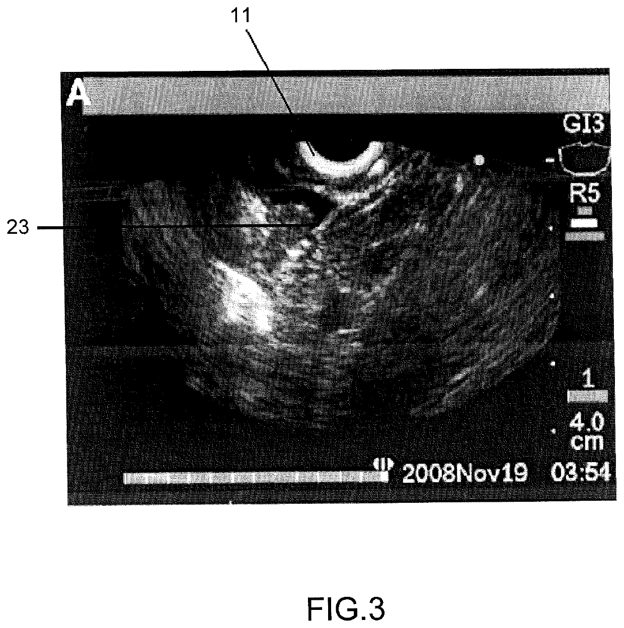 Method, an optical probe and a confocal microscopy system for inspecting a solid organ