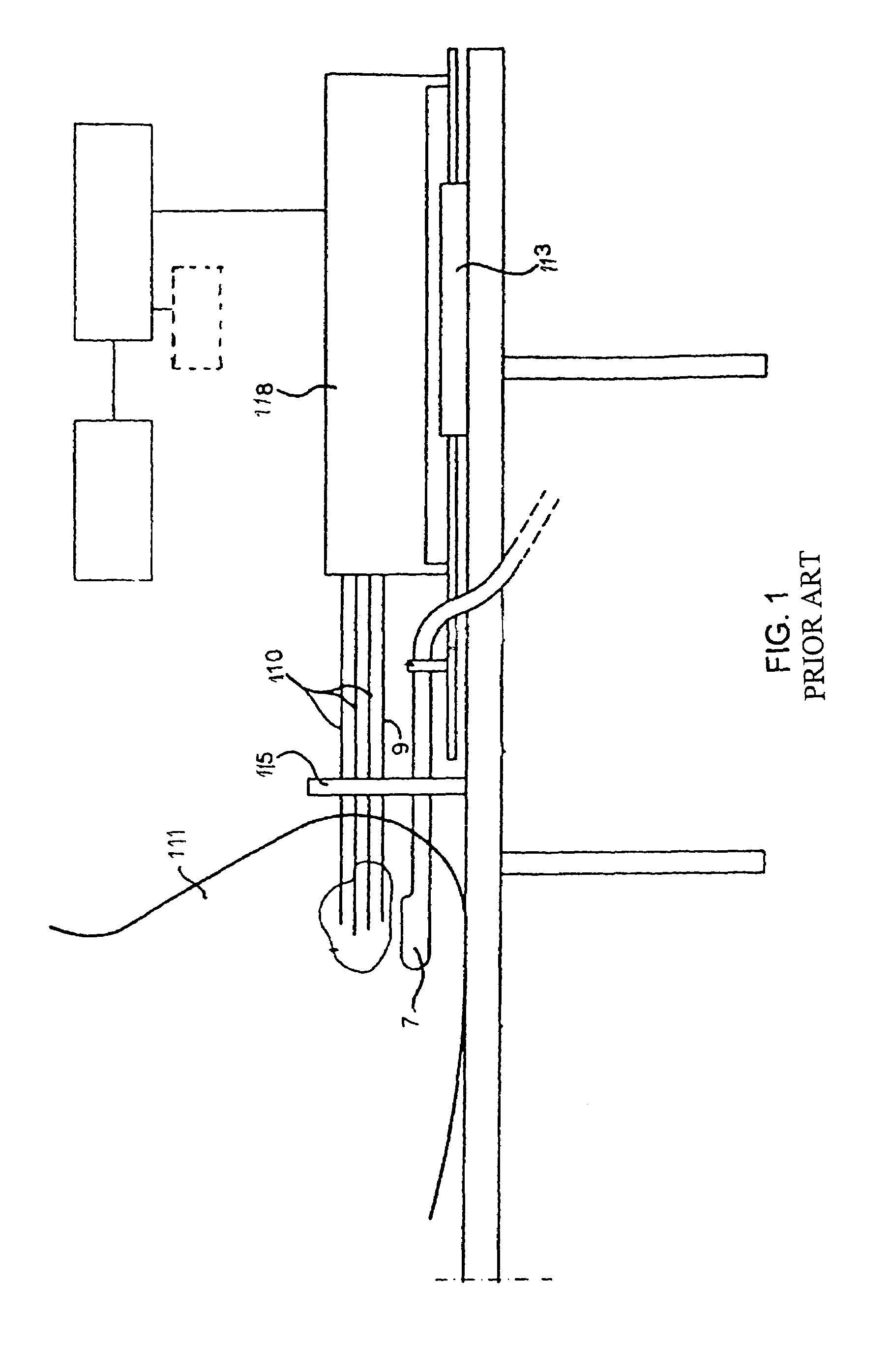 Urethral prove device for effecting radiation treatment