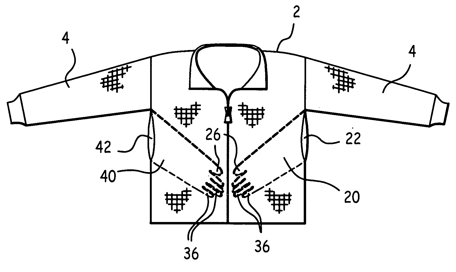 Garment with underarm externally accessible breast pockets and method of use
