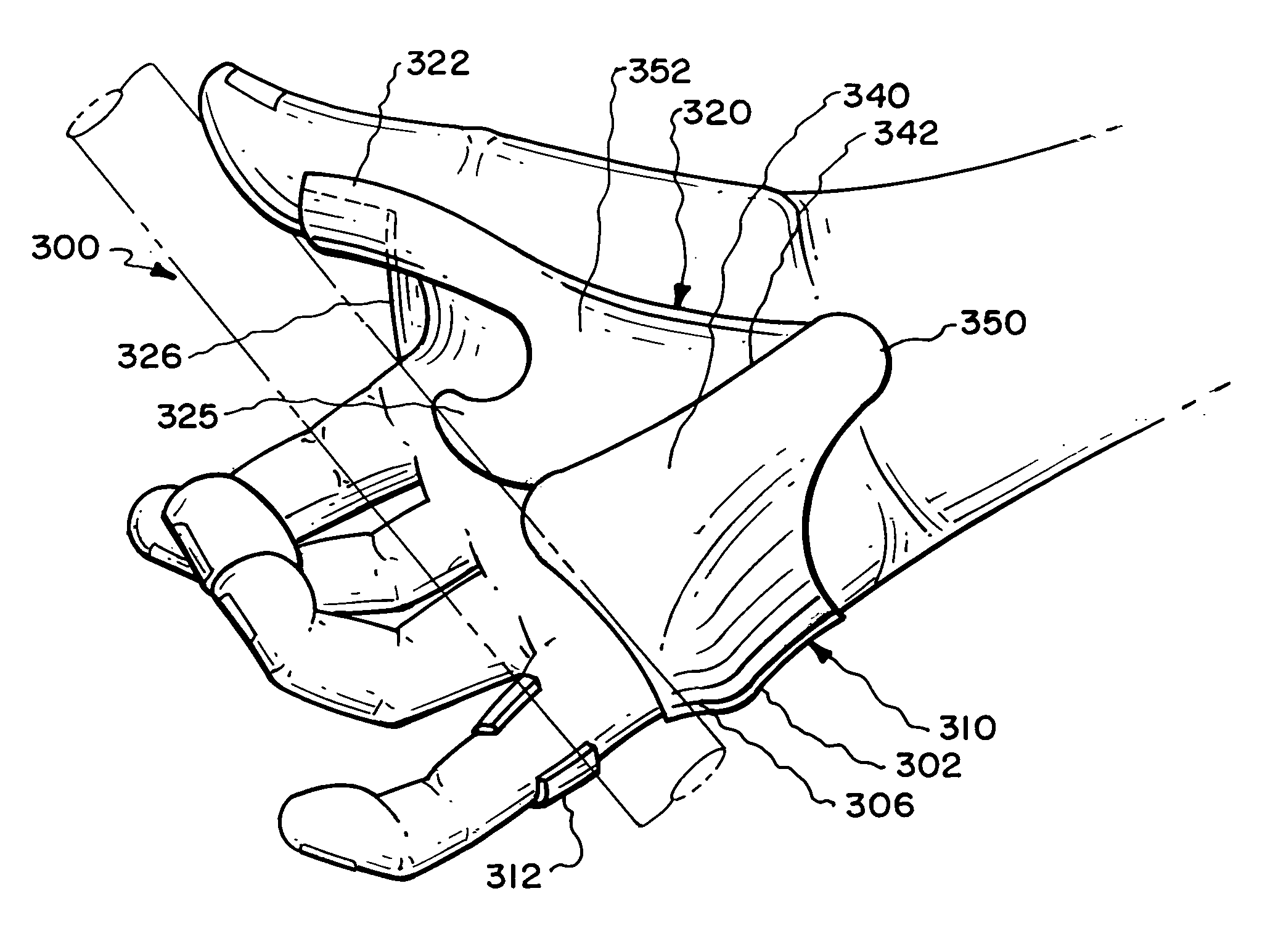 Hand accessory usable with an implement handle