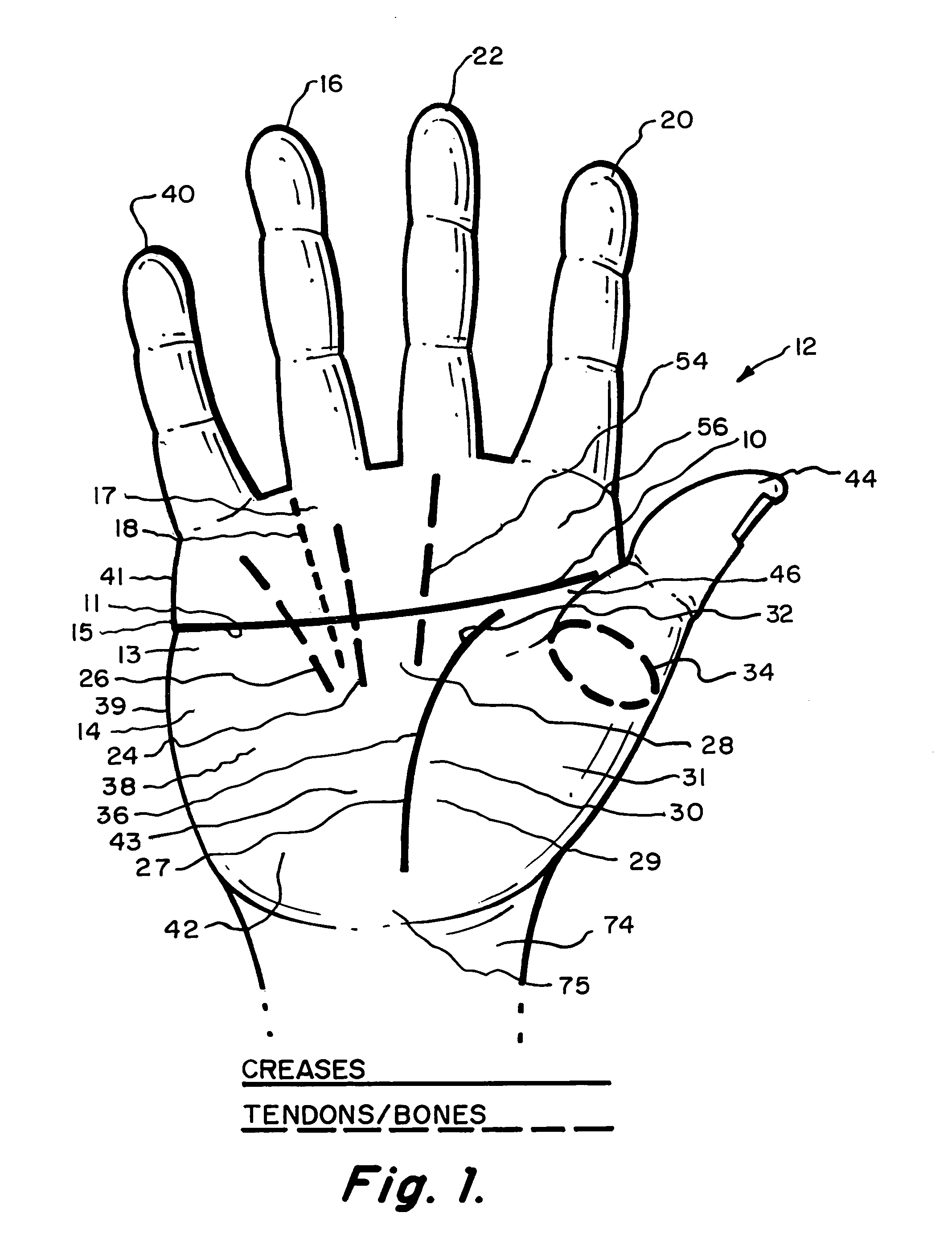 Hand accessory usable with an implement handle