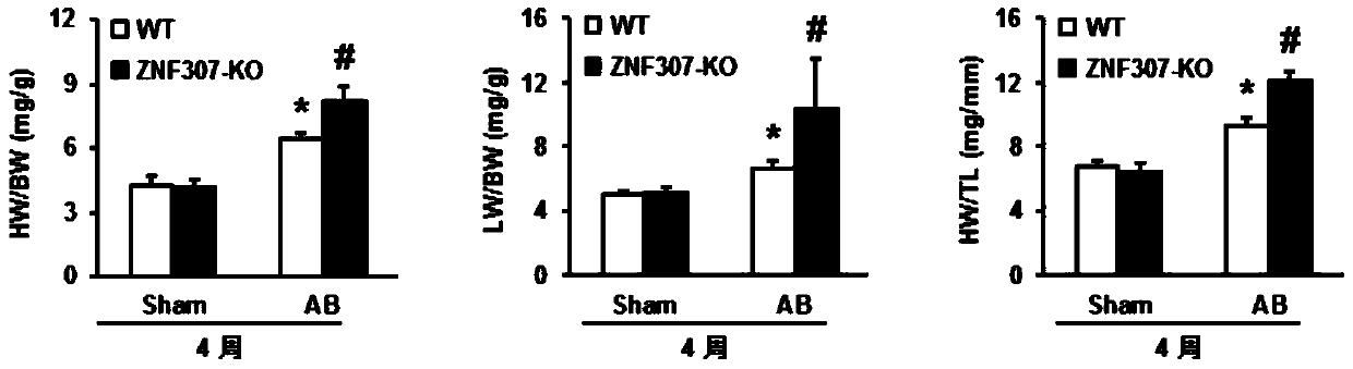Application of zinc finger protein 307 (znf307) in the treatment of cardiac hypertrophy