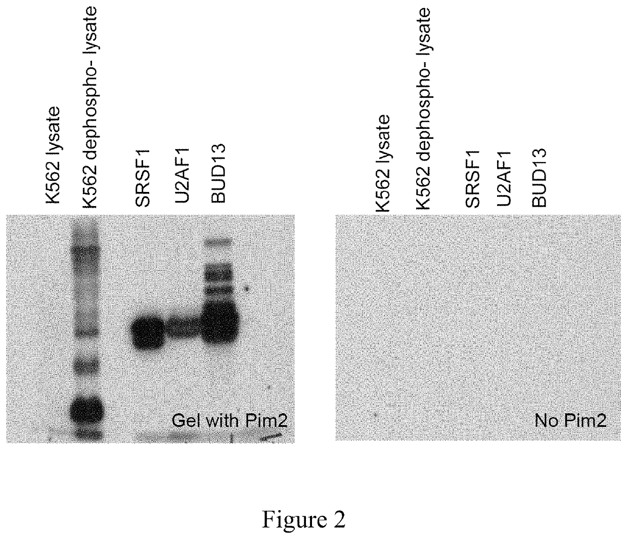 PIM kinase inhibitors in combination with RNA splicing modulators/inhibitors for treatment of cancers