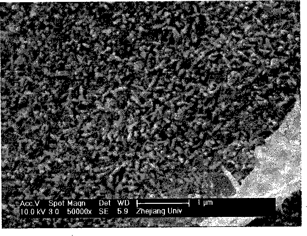 Method for preparation of collagen / chitose supporting stand of composite hydroxylapatite