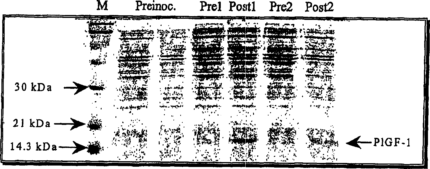 Process for preparing recombined placental growth factor