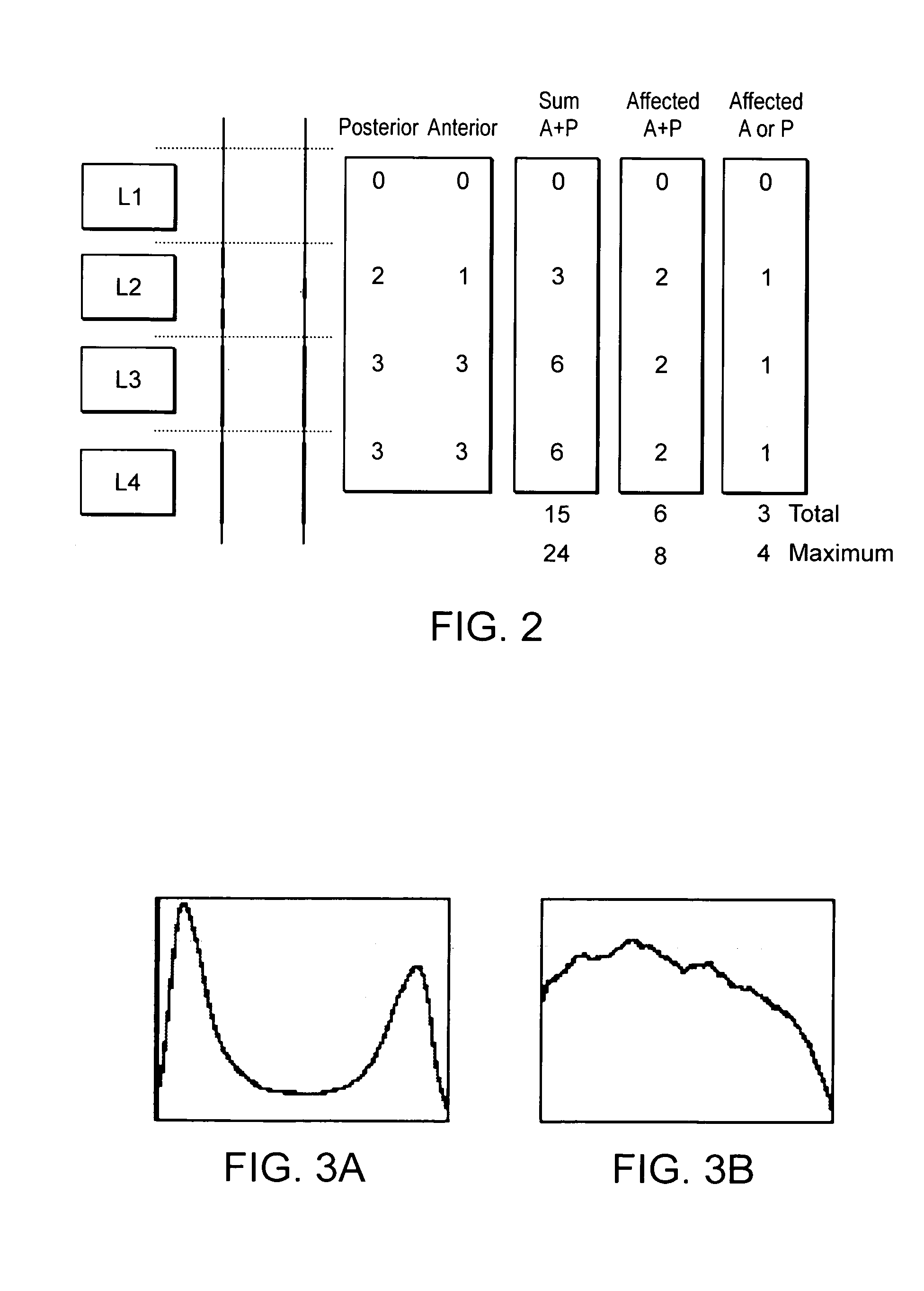 Method of deriving a quantitative measure of a degree of calcification of an aorta