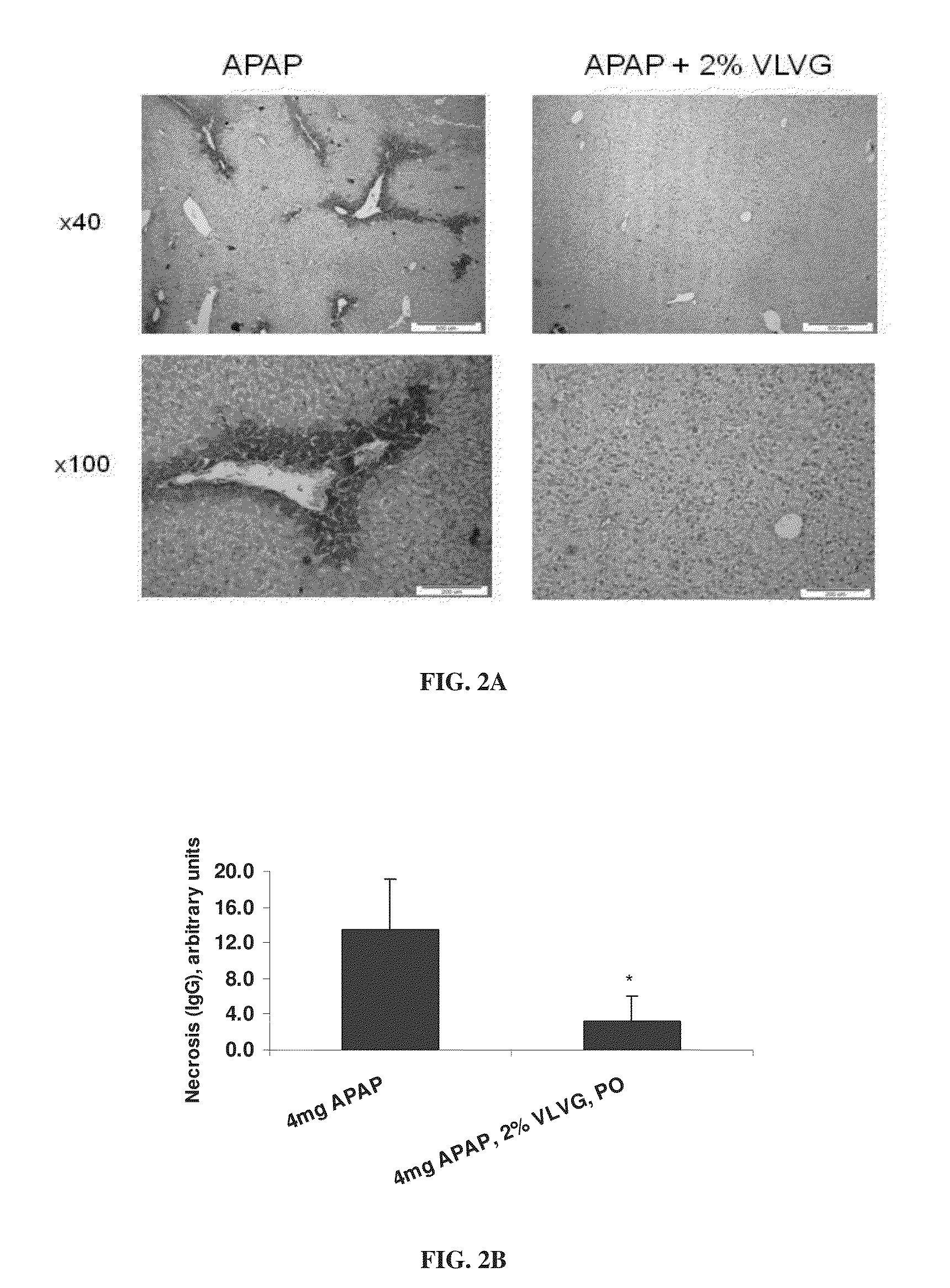 Use of alginate compositions in preventing or reducing liver damage caused by a hepatotoxic agent