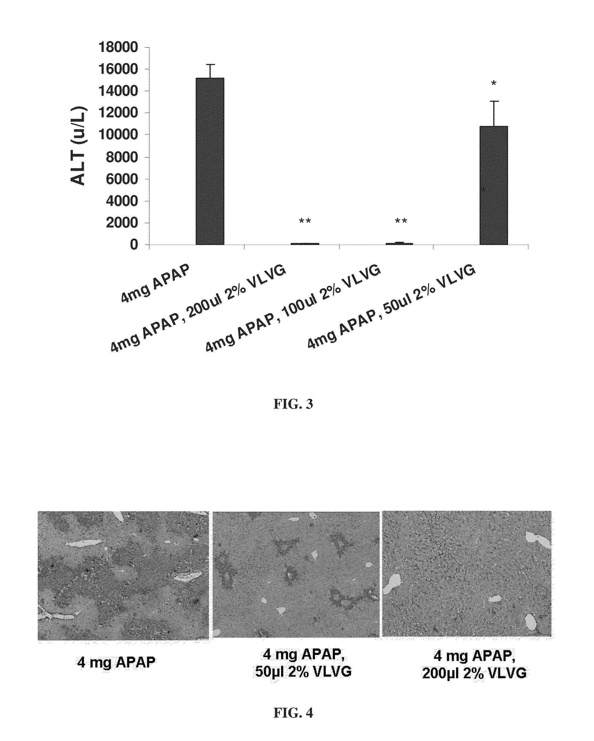 Use of alginate compositions in preventing or reducing liver damage caused by a hepatotoxic agent