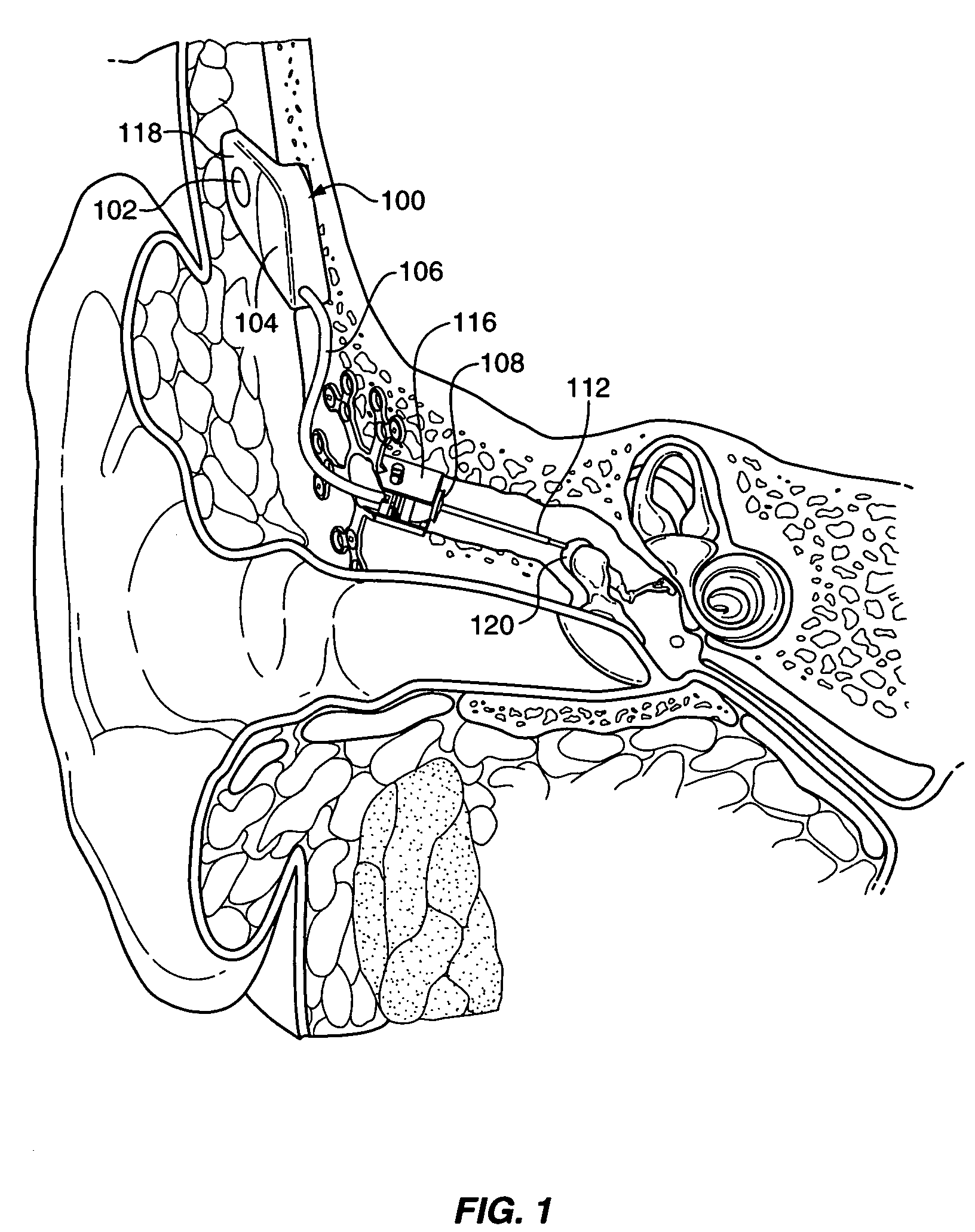 Transducer to actuator interface