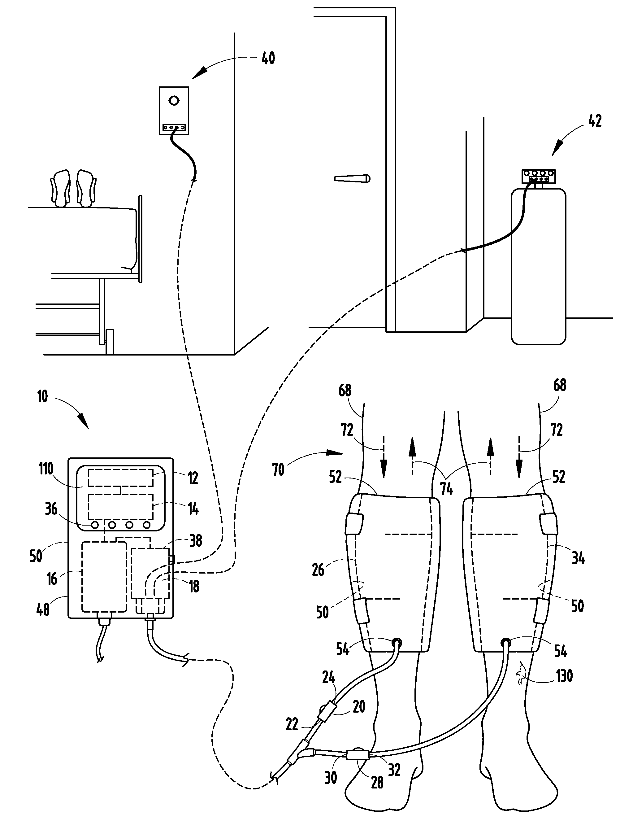Compression device and control system for applying pressure to a limb of a living being