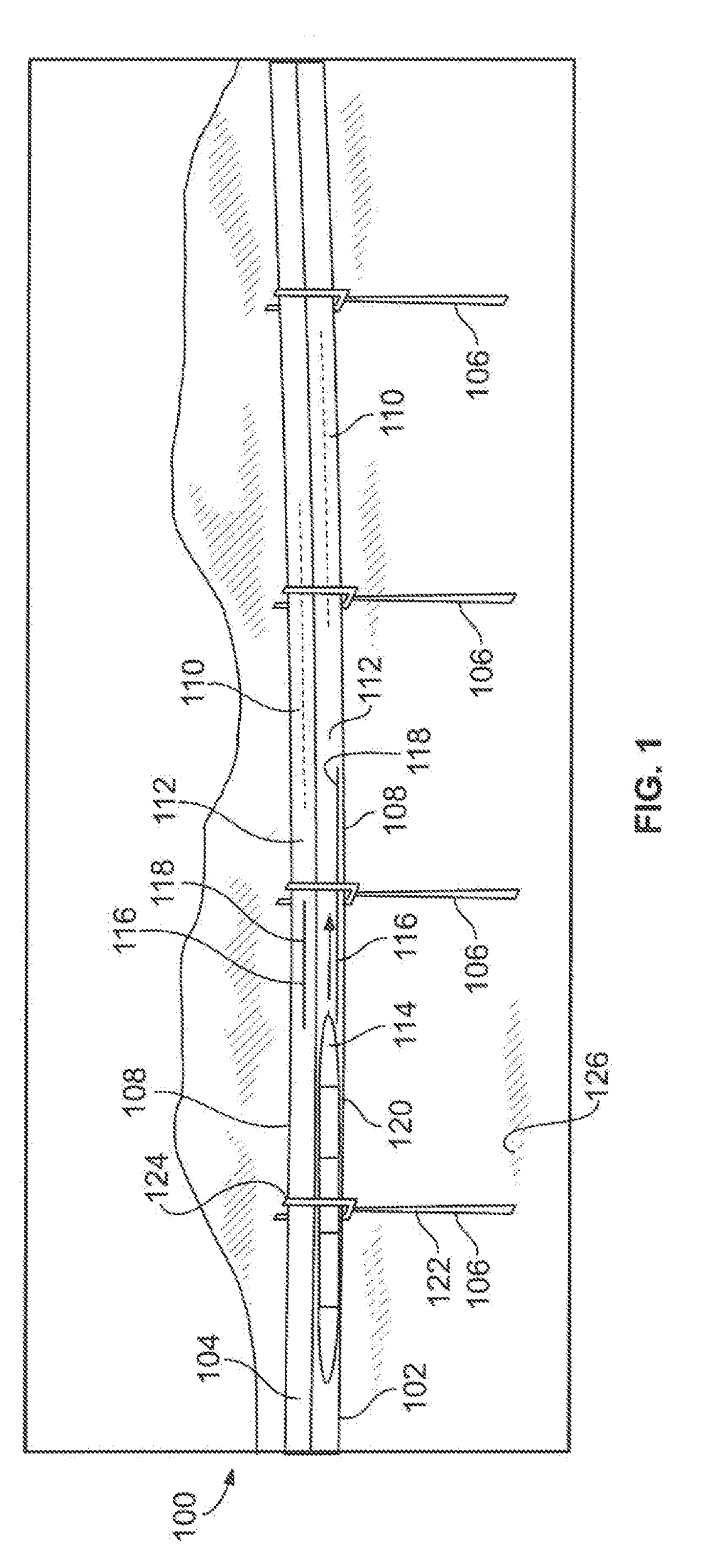 Support systems and methods for a transportation system