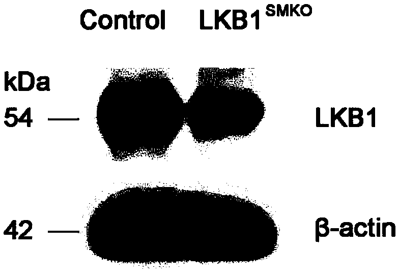 Application of LKB1 gene in preparation of anti-abdominal-aortic-aneurysm drugs