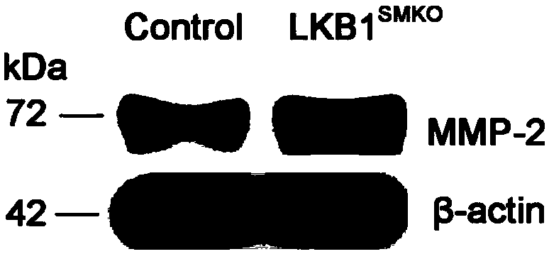 Application of LKB1 gene in preparation of anti-abdominal-aortic-aneurysm drugs
